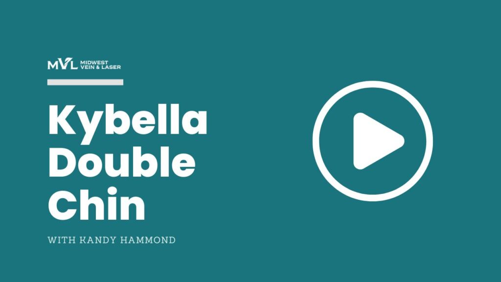 Kybella Double Chin MVL video tmb
