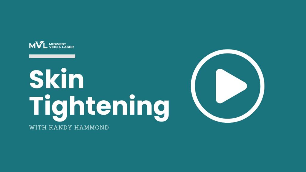 Skin Tyte Skin Tightening MVL video tmb (3)